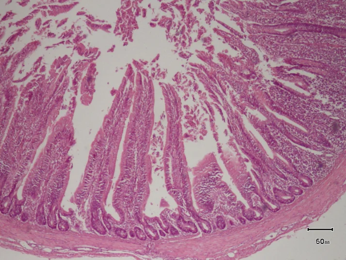 Antibiotic · duodenum (40×) histology micrograph