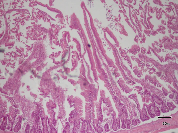 Essync · duodenum (40×) histology micrograph